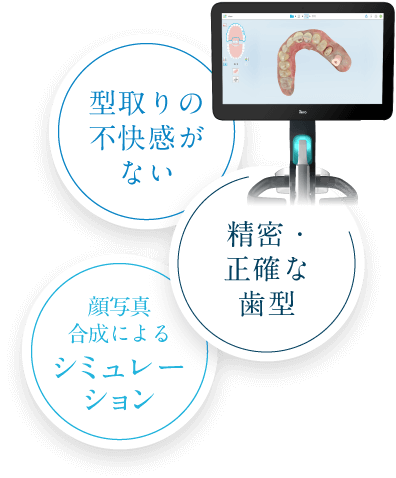 型取りの不快感がない　精密・正確な歯型　顔写真合成によるシミュレーション