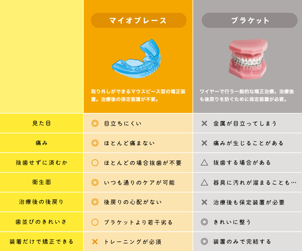 マイオブレース：取り外しができるマウスピース型の矯正装置。治療後の保定装置が不要。 ブラケット：ワイヤーで行う一般的な矯正治療。治療後も後戻りを防ぐために保定装置が必要。