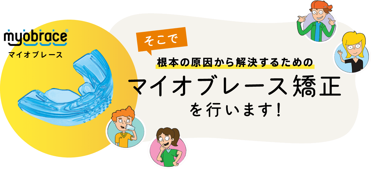 根本の原因から解決するためのマイオブレース矯正を行います！