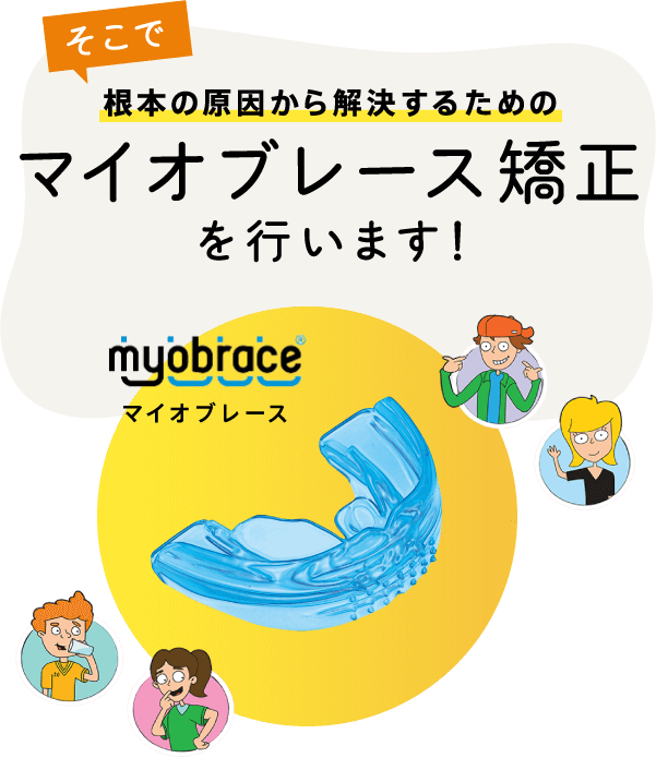 根本の原因から解決するためのマイオブレース矯正を行います！