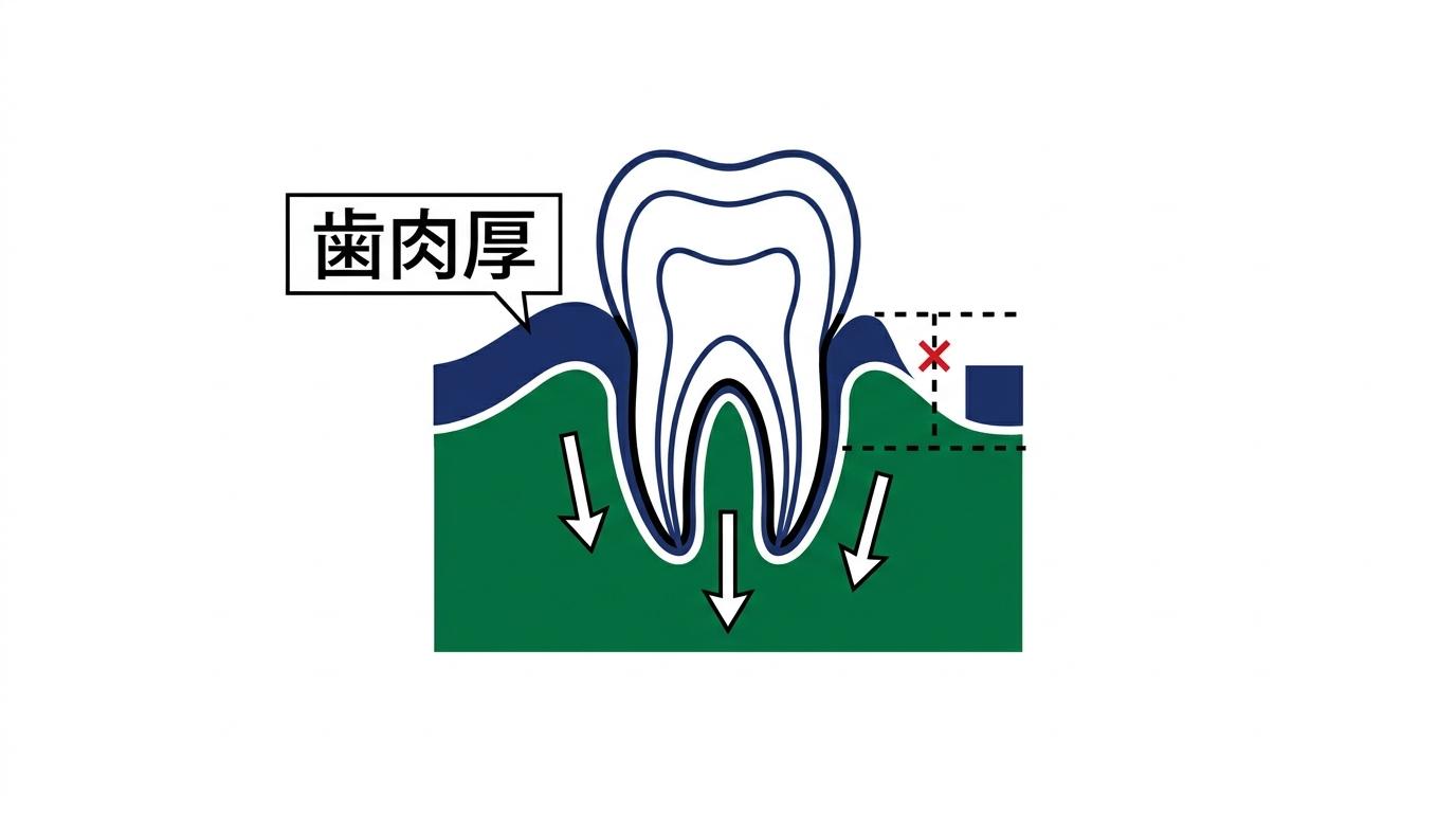 大人の矯正と歯肉の厚み：安全な移動限界とフェノタイプ