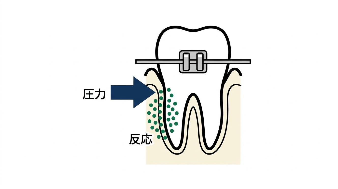 矯正治療で痛みが発生するメカニズムの図解