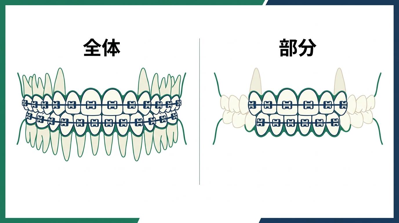 全体矯正と部分矯正の期間の違いの図解