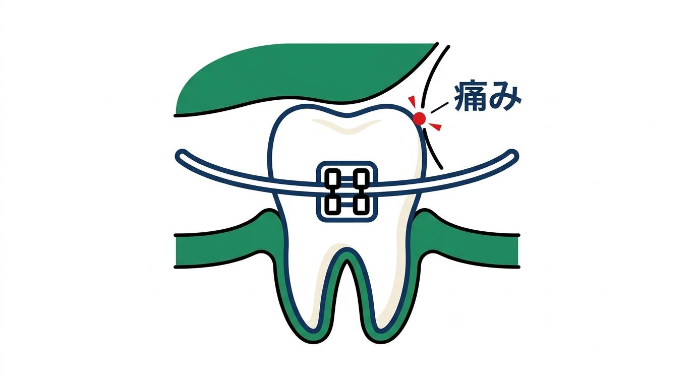 装置が粘膜や舌に当たっていることによる物理的な痛みの図解